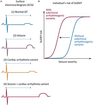 Are Variants Causing Cardiac Arrhythmia Risk Factors in Sudden Unexpected Death in Epilepsy?